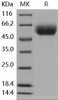 Mouse IL13RA1 Recombinant Protein (RPES3848)