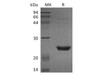 Human UBE2M/UBC12 Recombinant Protein (RPES3853)