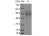 Human EDNRB/Endothelin B Receptor Recombinant Protein (Fc Tag) (RPES3856)