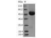 Rat CD5 Recombinant Protein (His Tag) (Active) (RPES3860)