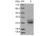 Human RELT/TNFRSF19L Recombinant Protein (His Tag) (RPES3864)
