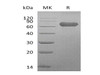 Human LTBR/TNFRSF3 Recombinant Protein (RPES3867)