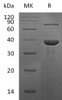 Human RBP3 Recombinant Protein (RPES3868)
