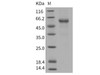 Human RELT/TNFRSF19L Recombinant Protein (His & Fc Tag) (RPES3887)