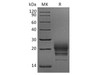 Rhesus macaque CD160 Recombinant Protein (RPES3922)