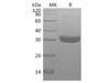 Human Kallikrein 7/KLK7 Recombinant Protein (RPES3940)