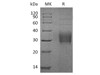 Human TROP2/TACSTD2 Recombinant Protein (RPES3941)