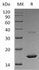 Human FGF-2/FGFb Recombinant Protein (aa 134-288) (Active) (RPES3954)
