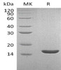 Human Lysozyme C/LYZ Recombinant Protein (RPES3955)