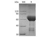 Human TROP2/TACSTD2 Recombinant Protein (RPES3963)