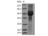 Mouse GFRA3/GFR-alpha-3 Recombinant Protein (His Tag) (RPES3971)
