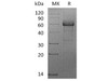 Human TNFRSF1B/CD120b Recombinant Protein (RPES3984)