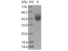 Human DPEP2 Recombinant Protein (Fc Tag) (RPES3987)