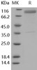 Human IL13RA2/CD213A2 Recombinant Protein (RPES3990)