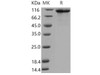 Mouse FGFR4/CD334 Recombinant Protein (His & Fc Tag) (Active) (RPES3993)