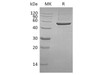 Human PGD Recombinant Protein (RPES4005)