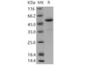 Human Calsequestrin/CASQ1 Recombinant Protein (RPES4009)