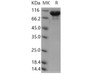 Human ERP72/PDIA4 Recombinant Protein (Fc Tag) (RPES4016)