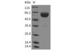 Rat Carboxypeptidase B2/CPB2 Recombinant Protein (His Tag) (RPES4021)