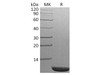 S. cerevisiae TIM14 Recombinant Protein (RPES4029)
