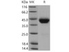 Mouse CD38 Recombinant Protein (RPES4036)