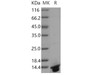 Human DNAJC30 Recombinant Protein (His Tag) (RPES4053)