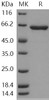 Human HEXA Recombinant Protein (Subunit A, His Tag) (Active) (RPES4054)