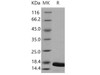 Mouse TNF-alpha/TNFA Recombinant Protein (aa 80-235) (Active) (RPES4097)