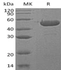 Human Sedoheptulokinase/SHPK Recombinant Protein (RPES4112)