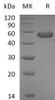 Mouse CD5L Recombinant Protein (His Tag) (RPES4114)