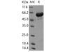 Human GALNT2/GalNAc-T2 Recombinant Protein (His Tag) (RPES4125)