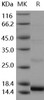 Human SLPI Recombinant Protein (RPES4128)