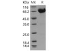 Mouse IL10RB/IL10R2 Recombinant Protein (RPES4130)