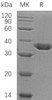 Carbonic Anhydrase 10/CA10 Recombinant Protein (RPES4134)