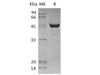 Human SCLY Recombinant Protein (RPES4137)