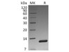 Vibrio cholerae Toxin B Recombinant Protein (RPES4147)