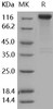 Human SLITRK1 Recombinant Protein (His & Fc Tag) (RPES4151)