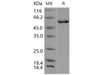 Mouse CAMK4/CaMKIV Recombinant Protein (RPES4153)