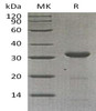 Carbonic Anhydrase 10/CA10 Recombinant Protein (RPES4157)