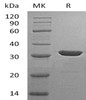 Carbonic Anhydrase 13/CA13 Recombinant Protein (RPES4181)