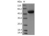 Rat DDR1 Kinase/CD167 Recombinant Protein (His Tag) (RPES4185)