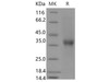 Human CD8 beta/CD8B Recombinant Protein (Fc Tag) (RPES4198)