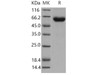 Mouse Activin Receptor 2B/ACVR2B Recombinant Protein (His & Fc Tag) (Active) (RPES4202)
