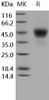 Human TROP2/TACSTD2 Recombinant Protein (RPES4204)