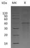 Carbonic Anhydrase 14/CA14 Recombinant Protein (RPES4205)