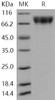Human c-KIT/CD117 Recombinant Protein (His Tag) (Active) (RPES4221)