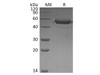 Human MD1 Recombinant Protein (RPES4240)