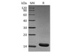 Rat TNF-alpha/TNFA Recombinant Protein (RPES4243)