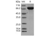 Mouse THOP1 Recombinant Protein (RPES4249)