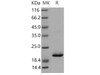 Mouse RBP4 Recombinant Protein (His Tag) (Active) (RPES4250)